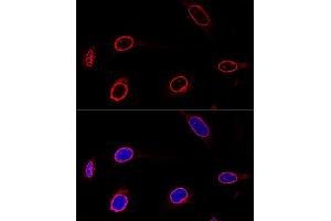 Confocal immunofluorescence analysis of U-2 OS cells using Emerin/Emerin/EMD Polyclonal Antibody  at dilution of 1:100. (Emerin antibody  (AA 1-220))