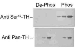 Western blot of recombinant phospho- and dephospho-Th showing selective immunolabeling by the phospho-specific antibody of the ~60k Th phosphorylated at Ser40. (Tyrosine Hydroxylase antibody)