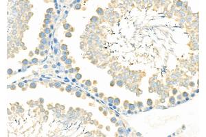 ABIN6265844 and ABIN6276978 at 1/100 staining Rat testis tissue by IHC-P.