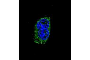 Confocal immunofluorescent analysis of TSHB Antibody (Center) (ABIN652558 and ABIN2842375) with MDA-M cell followed by Alexa Fluor® 488-conjugated goat anti-rabbit lgG (green). (TSHB antibody  (AA 58-86))
