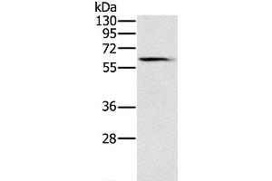 Western Blot analysis of Human fetal brain tissue using SLC45A3 Polyclonal Antibody at dilution of 1:200 (SLC45A3 antibody)