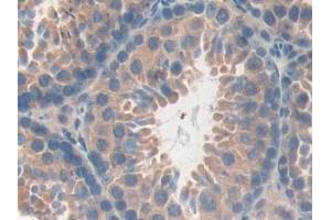 Detection of DEP1 in Mouse Testis Tissue using Polyclonal Antibody to Density Enhanced Phosphatase 1 (DEP1)