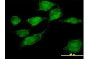 Immunofluorescence of purified MaxPab antibody to SNX11 on HeLa cell.