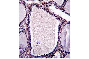 NSF Antibody (N-term) (ABIN657508 and ABIN2846532) immunohistochemistry analysis in forlin fixed and paraffin embedded hun thyroid tissue followed by peroxidase conjugation of the secondary antibody and DAB staining. (NSMAF antibody  (N-Term))