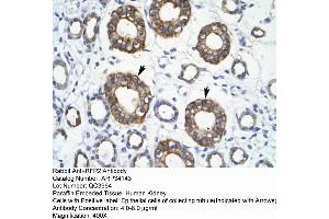 Human kidney (TRIM13 antibody  (Middle Region))