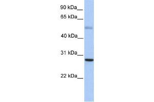 Western Blotting (WB) image for anti-MAX Dimerization Protein 1 (MXD1) antibody (ABIN2458296)
