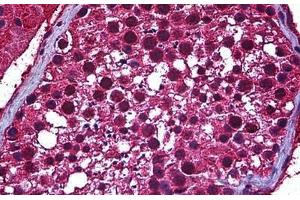 Human Testis: Formalin-Fixed, Paraffin-Embedded (FFPE) (SP140 antibody  (AA 504-613))
