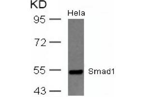 Image no. 2 for anti-SMAD, Mothers Against DPP Homolog 1 (SMAD1) (AA 461-465) antibody (ABIN319351) (SMAD1 antibody  (AA 461-465))