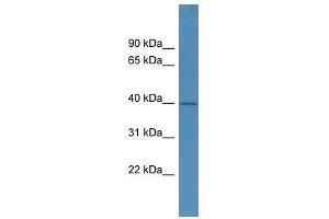 PHYHIPL antibody used at 0. (PHYHIPL antibody  (C-Term))