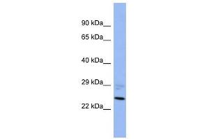 PPM1B antibody used at 1 ug/ml to detect target protein. (PPM1B antibody)