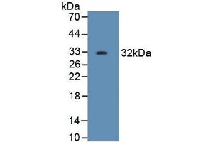 Detection of Recombinant HPR, Human using Monoclonal Antibody to Haptoglobin Related Protein (HPR)