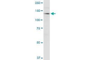 CDAN1 monoclonal antibody (M01), clone 7A10. (Codanin 1 (CDNA1) (AA 1130-1227) antibody)