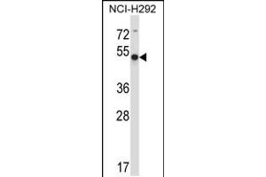 Western blot analysis in NCI-H292 cell line lysates (35ug/lane). (ACTR6 antibody  (C-Term))