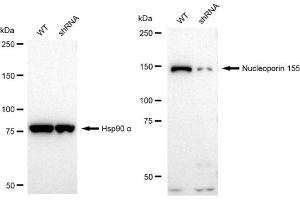 Western blotting analysis using Nucleoporin 155 antibody (ABIN7799675). (Recombinant NUP155 antibody)