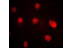 Immunofluorescent analysis of Pr-Set7 staining in MCF7 cells. (SETD8 antibody)