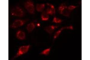 ABIN6275913 staining Hela cells by IF/ICC. (Adenosine A2a Receptor antibody  (Internal Region))