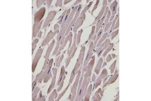 (ABIN6243895 and ABIN6578867) staining MYL1 in human heart tissue sections by Immunohistochemistry (IHC-P - paraformaldehyde-fixed, paraffin-embedded sections). (MYL1 antibody  (AA 24-58))