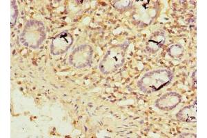 Immunohistochemistry of paraffin-embedded human small intestine tissue using ABIN7176140 at dilution of 1:100 (ZNF19 antibody  (AA 1-200))