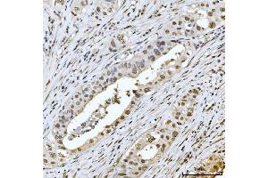 IHC analysis of MRE11 using anti-MRE11 antibody (ABIN7600025). (Mre11 antibody  (AA 14-481))