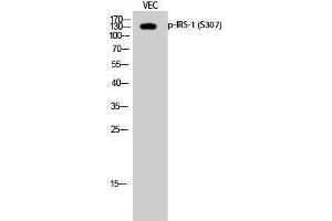 Western Blotting (WB) image for anti-Insulin Receptor Substrate 1 (IRS1) (pSer307) antibody (ABIN3182046)