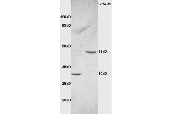Ceramide Synthase 2 antibody  (AA 201-300)