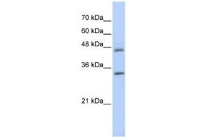 PRELP antibody used at 1 ug/ml to detect target protein.