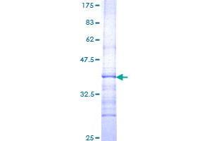 GBA Protein (AA 146-235) (GST tag)