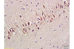 Formalin-fixed and paraffin embedded rat hippocampus labeled with Anti-SYN1/Synapsin 1 Polyclonal Antibody, Unconjugated (ABIN747263) at 1:300 followed by conjugation to the secondary antibody and DAB staining (SYN1 antibody  (AA 201-300))