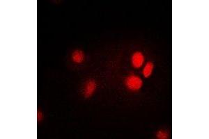 Immunofluorescent analysis of Thymopoietin staining in HepG2 cells. (Thymopoietin antibody)