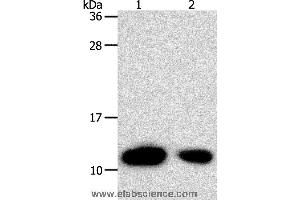 Western blot analysis of Hela cell and human liver cancer tissue, using TXN Polyclonal Antibody at dilution of 1:700 (TXN antibody)
