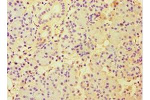 Immunohistochemistry of paraffin-embedded human pancreatic tissue using ABIN7151000 at dilution of 1:100 (CBLC antibody  (AA 245-474))