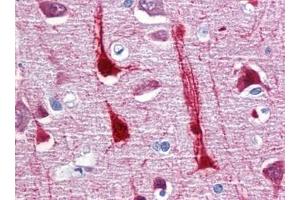 Immunohistochemistry (IHC) image for anti-Crystallin, mu (CRYM) (AA 215-315) antibody (ABIN614593) (CRYM antibody  (AA 215-315))