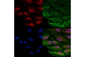 ABIN6263148 and ABIN6278191 staining  cells by IF/ICC. (MBD2 antibody  (Internal Region))