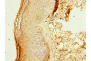 Immunohistochemistry of paraffin-embedded human skin tissue using ABIN7176485 at dilution of 1:100 (ZNF688 antibody  (AA 1-276))