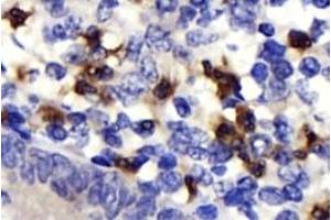 Immunohistochemistry analysis of paraffin-embedded human epityphlon using,NK-p44 (ABIN7074778) at dilution of 1: 500 (NKp44/NCR2 antibody)