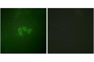 Immunofluorescence analysis of A549 cells, using eIF4B (Ab-422) Antibody. (EIF4B antibody  (AA 388-437))