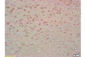 Immunohistochemistry (IHC) image for anti-Macrophage Stimulating 1 (Hepatocyte Growth Factor-Like) (MST1) (AA 385-487) antibody (ABIN747308)