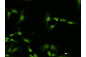 Immunofluorescence of purified MaxPab antibody to PI4K2A on HeLa cell.