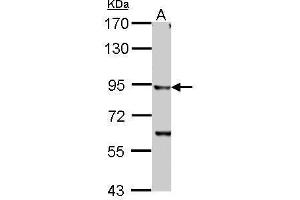 WB Image IKK beta antibody detects IKBKB protein by Western blot analysis. (IKBKB antibody  (C-Term))