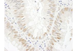 Immunohistochemistry (IHC) image for anti-BRCA2 and CDKN1A Interacting Protein (BCCIP) (AA 300-350) antibody (ABIN7448933)