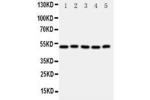 Western Blotting (WB) image for anti-Aldehyde Dehydrogenase 3 Family, Member A1 (ALDH3A1) (AA 440-453), (C-Term) antibody (ABIN3042917) (ALDH3A1 antibody  (C-Term))