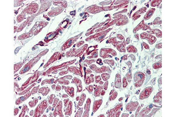 PHACTR1 antibody  (AA 468-517)