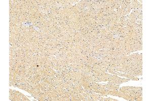 ABIN7094628 and ABIN7098678 at 1/100 staining Rat heart tissue by IHC-P. (LOXL2 antibody  (Internal Region))