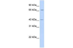 WB Suggested Anti-CCDC138 Antibody Titration: 0. (CCDC138 antibody  (N-Term))