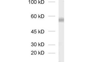 dilution: 1 : 1000, sample: synaptic vesicle fraction of rat brain (LP2) (SLC17A8 antibody  (C-Term))