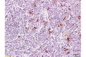 Formalin-fixed and paraffin embedded rat thymus tissue labeled Anti-PCNA Polyclonal Antibody, Unconjugated (ABIN672756) at 1:200, followed by conjugation to the secondary antibody and DAB staining (PCNA antibody  (AA 185-261))