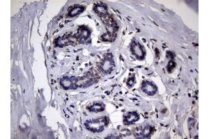 Image no. 2 for anti-Ribonucleotide Reductase M1 (RRM1) (AA 541-792) antibody (ABIN1491583) (RRM1 antibody  (AA 541-792))