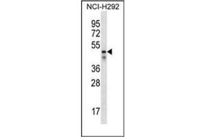 Western blot analysis of PDZK1 Antibody (Center) in NCI-H292 cell line lysates (35ug/lane). (PDZK1 antibody  (Middle Region))