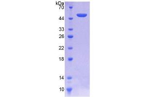 SDS-PAGE analysis of Human SPINT2 Protein. (SPINT2 Protein)