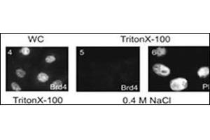 Subnuclear distribution of cellular proteins. (BRD4 antibody  (AA 1313-1342))